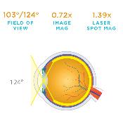 Loupe de Volk Digitale Wide Field