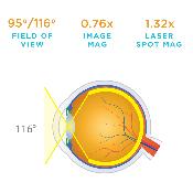 Loupe de Volk Superfield