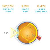 Loupe de Volk 30D